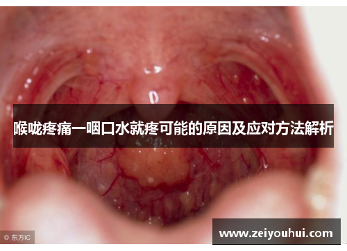 喉咙疼痛一咽口水就疼可能的原因及应对方法解析